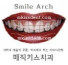오래 사용 가능한 ‘치아성형’ 시술법 소개