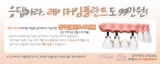 매직키스치과, 시술시간 짧고 치유 빠른 레이저 임플란트 이벤트 진행중