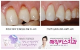 매직키스치과, 겨울이면 심해지는 ‘이시림’ 증상 5분이면 간단히 해결