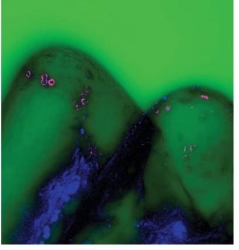 해양생물에 큰 위협이 되는 미세 플라스틱 입자