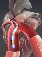 한국산업기술평가관리원, 로봇산업 육성 전략 펼쳐