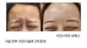 나를 바보로 아나