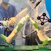 순천척병원, 무릎 로봇수술 센터 강화 나선다